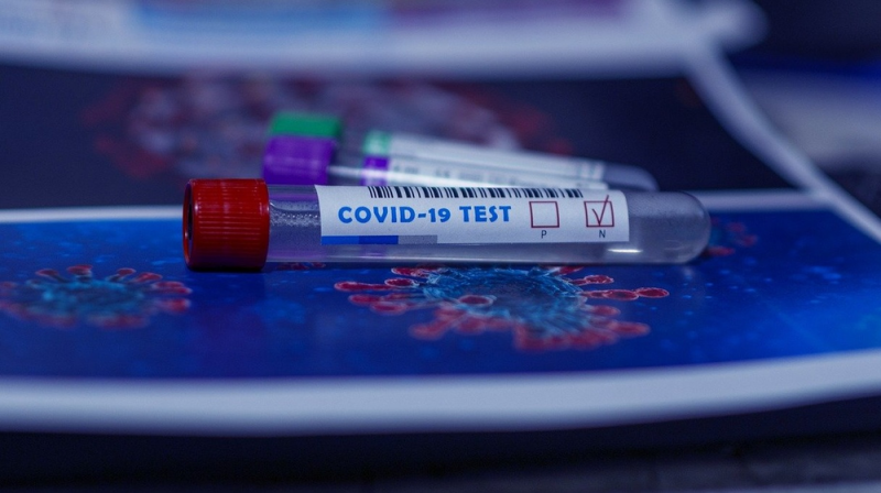 В России создан стандартный образец штамма коронавируса